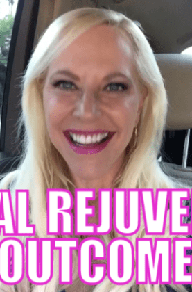 Vaginal Rejuvenation Outcome